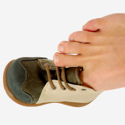 big toe in tiny shoe